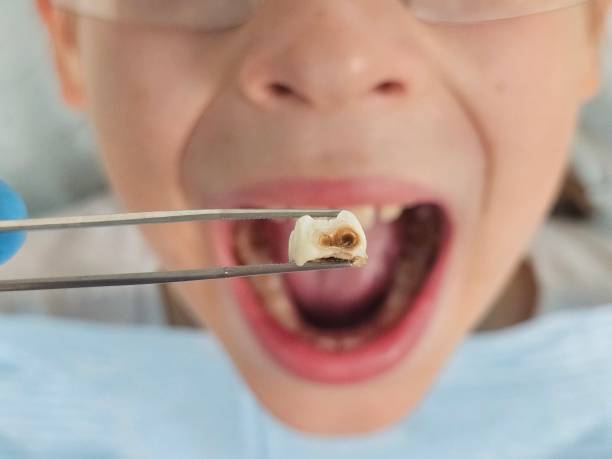 Best Emergency Treatment for Toothache in Hampton, AR